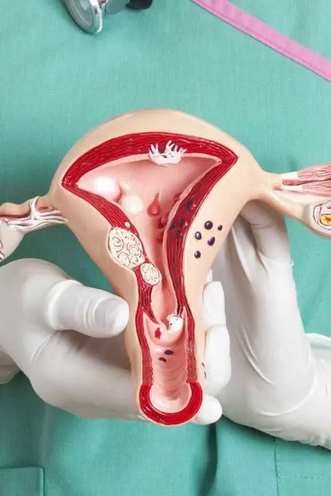 Гострий параметрит: <br> <span class='text-primary-400 font-bold text-4xl  lg:text-6xl xl:text-7xl'>невідкладне лікування</span>