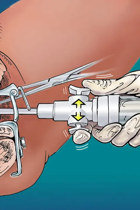 Біопсія в гінекології: <br> <span class='text-primary-400 font-bold text-3xl  lg:text-5xl xl:text-6xl'>ключ до точної діагностики</span>