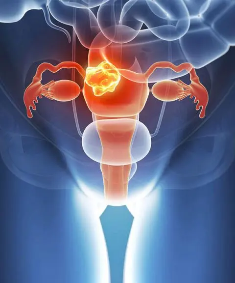 Лечение <br> <span class='text-primary-400 font-bold text-4xl  lg:text-6xl xl:text-7xl'>эрозии шейки матки</span>